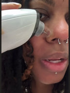 Blackhead Remover Pore Vacuum Cleaner